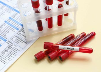 Government committed to upscaling PrEP update to beat HIV infections