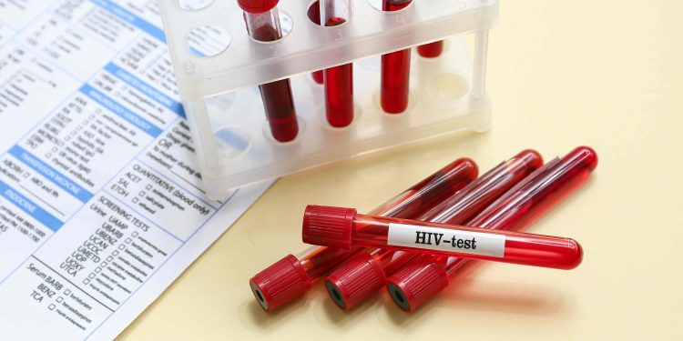 Government committed to upscaling PrEP update to beat HIV infections